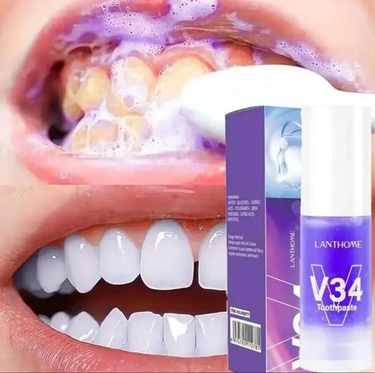 Mousse dentifrice blanchissante V34